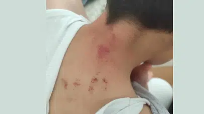 Şanlıurfa’da öğrenciyi darbeden öğretmen tutuklandı