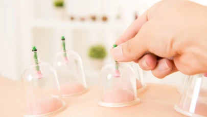 Hacamat nedir? Hacamat ne sıklıkla yapılmalı?