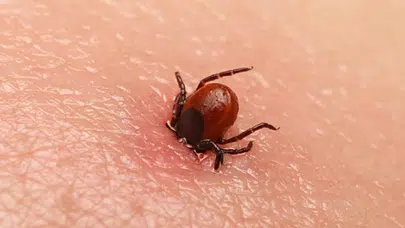 Kene ısırığında hayat kurtaran ilk adım