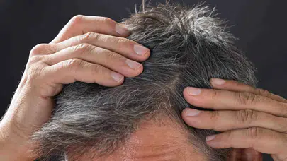 Beyaz saç kopardıkça çoğalır mı? Gerçek sandığınız gibi değil!