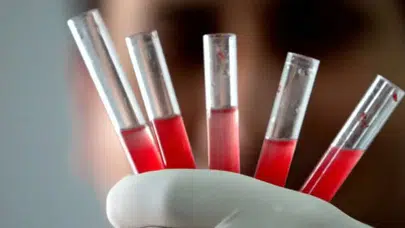 Dünyada sadece bir kişide bulunan yeni kan grubu tespit edildi!