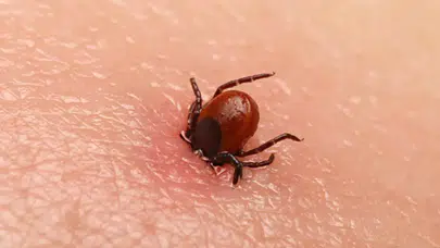 Parkta oynayan 3 yaşındaki kızın kulağına kene yapıştı