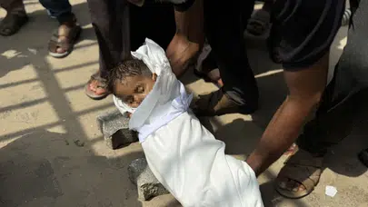 Gazze’de açlık can aldı: 5 yaşındaki Muhammed yetersiz beslenmeden hayatını kaybetti