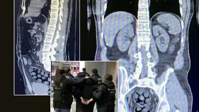 İranlı yolcu bağırsağında ve midesinde uyuşturucu ile yakalandı