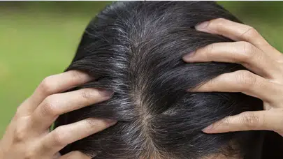 Saç beyazlaması neden olur, nasıl durdurulur?