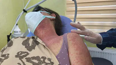 Van'da beyazlatıcı krem faciaya yol açtı: 4 kişi hastaneye kaldırıldı!