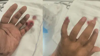 Uyuşturucu ile yakalandı: Polisin parmağını kopardı!