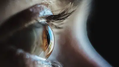 Doktorları şaşırtan vaka: Gözünden canlı solucan çıktı!