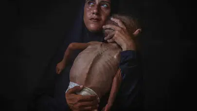 Gazze'de açlık bir çocuğu daha hayattan kopardı!