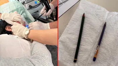 Ağrı'da genç bir kadının midesinden 2 kalem çıkarıldı!