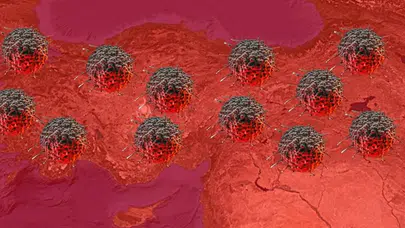 Türkiye'de Kanser Oranları Neden Bu Kadar Yüksek? TÜİK Verileri Açıkladı