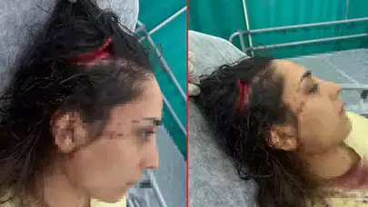 Adana’da bakkala giden kadın sokak köpeklerinin saldırısında yaralandı