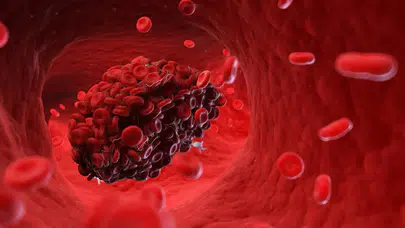 COVID aşılarının sebep olduğu kan pıhtılarının sebebi tespit edildi