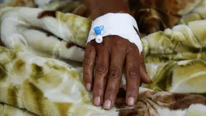 Zambiya'da kolera salgını : Son 24 saatte 20 vaka tespit edildi