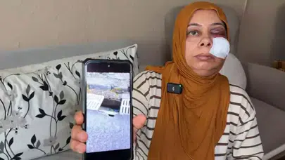 Elektrikli bisikletle kapağı kırık rögara düştü, yüzüne 14 dikiş atıldı