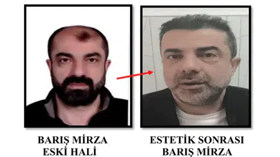 Estetikli firari 7 yıl sonra yakalandı
