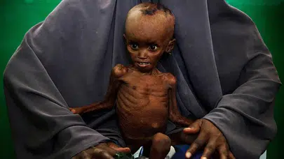 Somali'de açlık krizi derinleşiyor : 6,5 milyon kişi risk altında