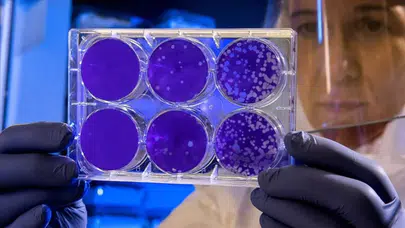 Hantavirüs vakası görülen lüks yolcu gemisine İspanya'dan izin çıktı