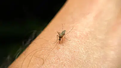 Sivrisineklerin en sevdiği insan tipi belli oldu! Eğer sizi sürekli ısırıyorlarsa sebebi bu