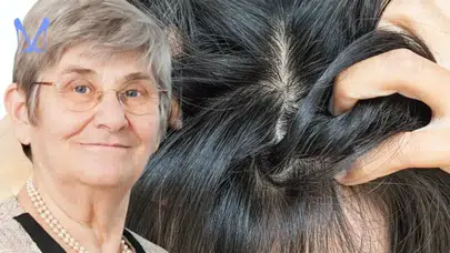 Saç diplerinde bitmek bilmeyen kaşıntıya kesin çözüm! Canan Karatay'dan gizli formül