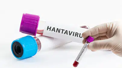 Venezuela'da hantavirüs alarmı : 3 kişi hayatını kaybetti