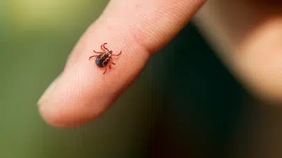 Ordu'da kene yapışan genç kadın KKKA şüphesiyle Sivas'ta hayatını kaybetti