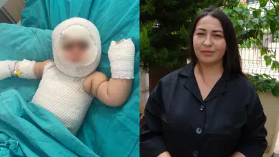Patlayan domates konservesi 9 aylık bebeği yaraladı