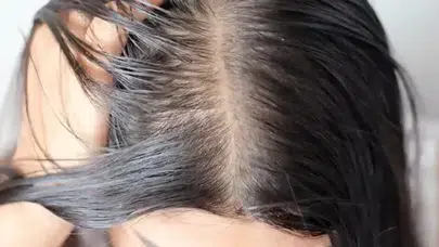 Saçlar neden sık yağlanır : Bu sorunun cevabı sizi şaşırtacak