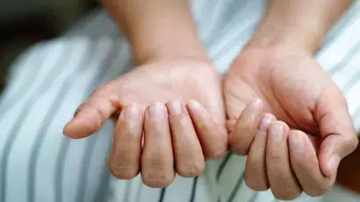 Tırnaklarınızdaki Değişiklikler Sağlığınız Hakkında Ne Anlatıyor?