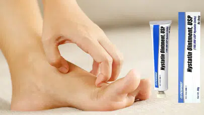 Nistatin Krem Antibiyotik Midir? Nistatin Krem Ne İşe Yarar?
