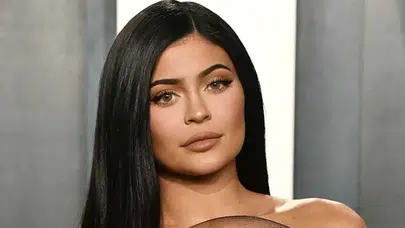 Dünyanın en genç milyaderi Kylie Jenner'ın estetikle değişimi ne?