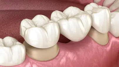 Diş Kaybı Neden Ölüm Riskini Artırıyor? Japonya'dan Şaşırtıcı Araştırma Sonuçları