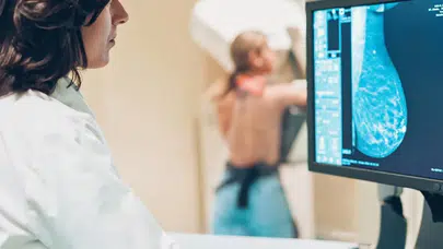 Kadınlarda En Yaygın Kanser Türü Olarak Meme Kanseri, 2050'ye Kadar 3,5 Milyona Ulaşabilir