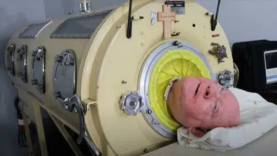 Paul Alexander kimdir, kaç yaşında, neden öldü ve hastalığı neydi?