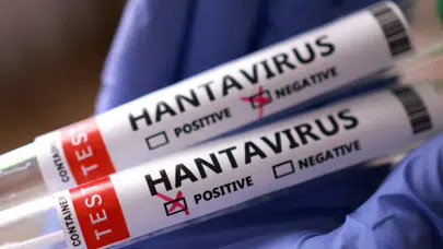 Hantavirüs nereden çıktı, kurgu mu? İlaç kartelleri üzerine çarpıcı iddialar