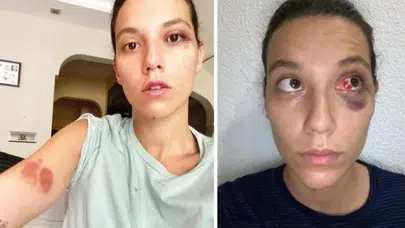 Deniz Bulutsuz olayı nedir, ne zaman yaşandı? Ozan Güven ceza aldı mı?