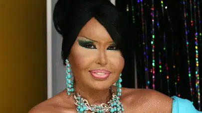 Bülent Ersoy ne estetiği yaptırdı? Lolita estetiği sonrası Bülent Ersoy'un yeni görünümü dikkat çekti