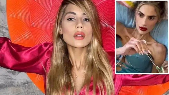 Nihal Candan’ın ardından uzmanlar uyardı: Anoreksiya nervoza sosyal medyadan bulaşıyor!