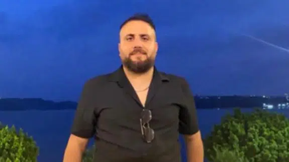 İstanbul Bağcılar’da burun ameliyatı olan 29 yaşındaki genç hayatını kaybetti