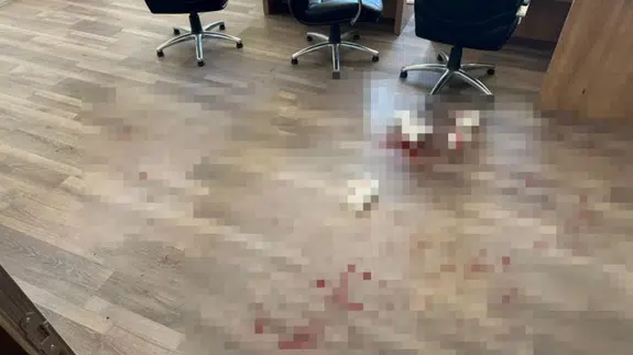 Yozgat'ta okul müdürünü darbeden veli tutuklandı