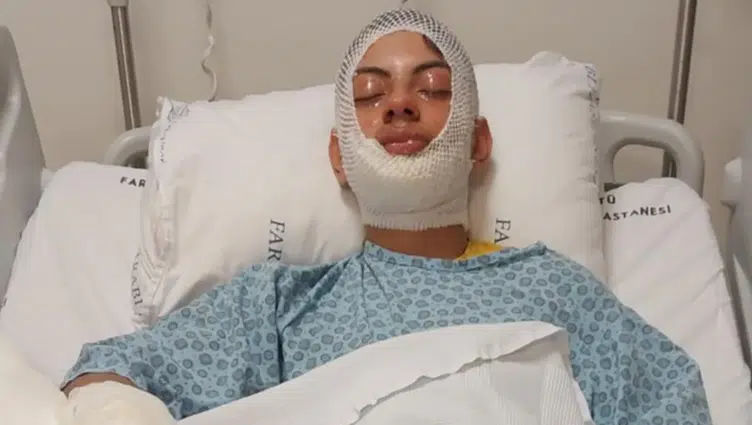 Trabzon'da bir genç ateşe benzin döktü, yaralandı