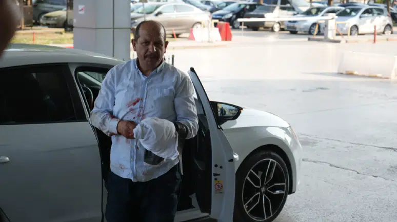 Acemi kasaplar acil servislik oldu