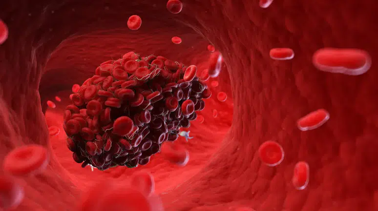 COVID aşılarının sebep olduğu kan pıhtılarının sebebi tespit edildi