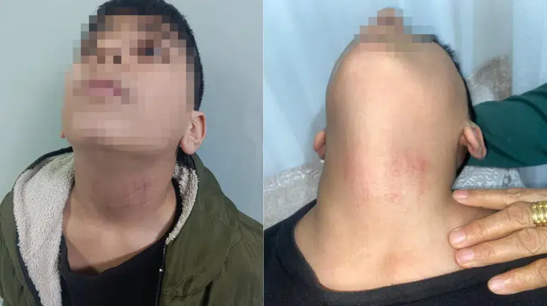 Kadın memur, 10 yaşındaki öğrencinin boğazını sıktı