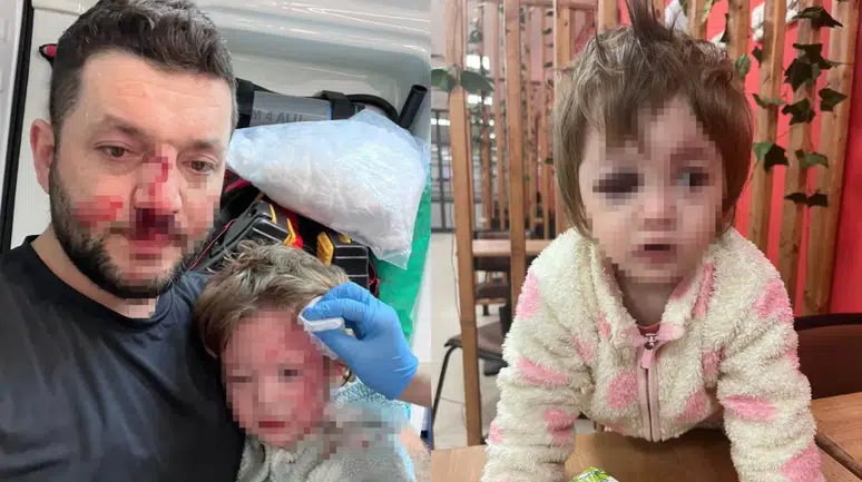 Yalova'daki kavgada darbedilen 14 aylık bebek taburcu edildi