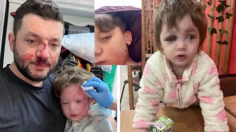 14 aylık bebeğe saldırmışlardı , şimdi de oğluna taş attılar