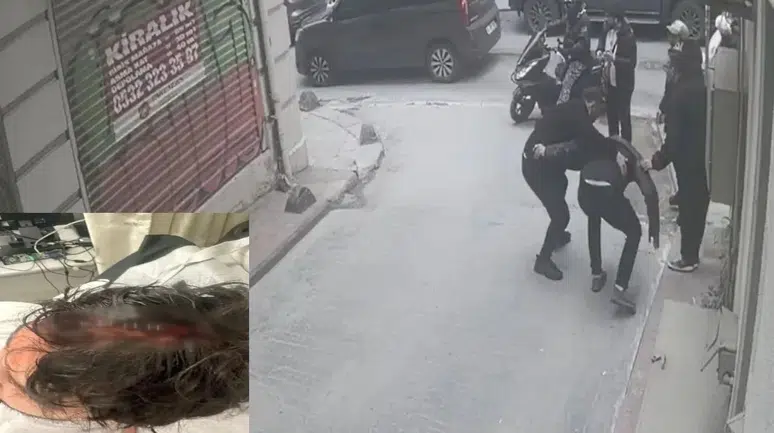 İstanbul’da kaldırımda yürüyen adamın başına cam parçaları düştü