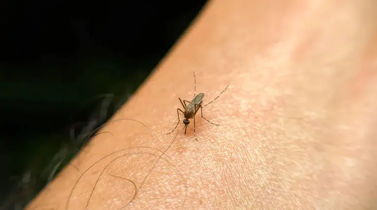 Sivrisineklerin en sevdiği insan tipi belli oldu! Eğer sizi sürekli ısırıyorlarsa sebebi bu