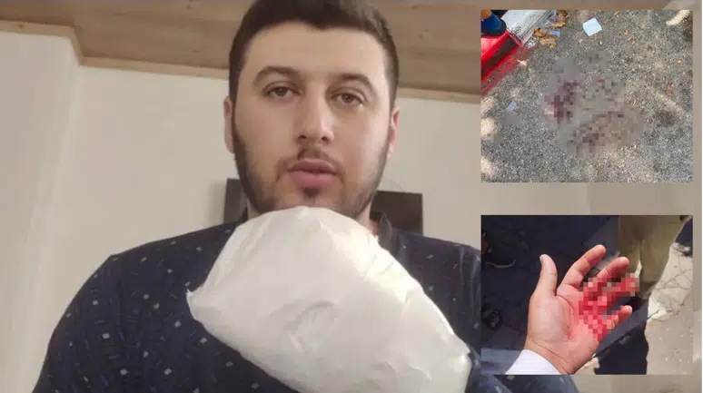 Sipariş almaya gitti, döner bıçaklı saldırıya uğradı