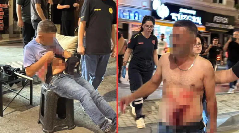 Aksaray'da bıçaklanan şahıs, yol ortasında soyundu